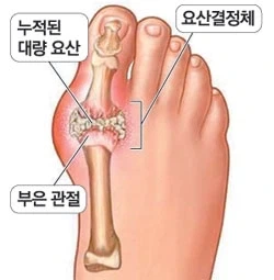 소시오패스 냉혈한 소녀만드는법_3.webp