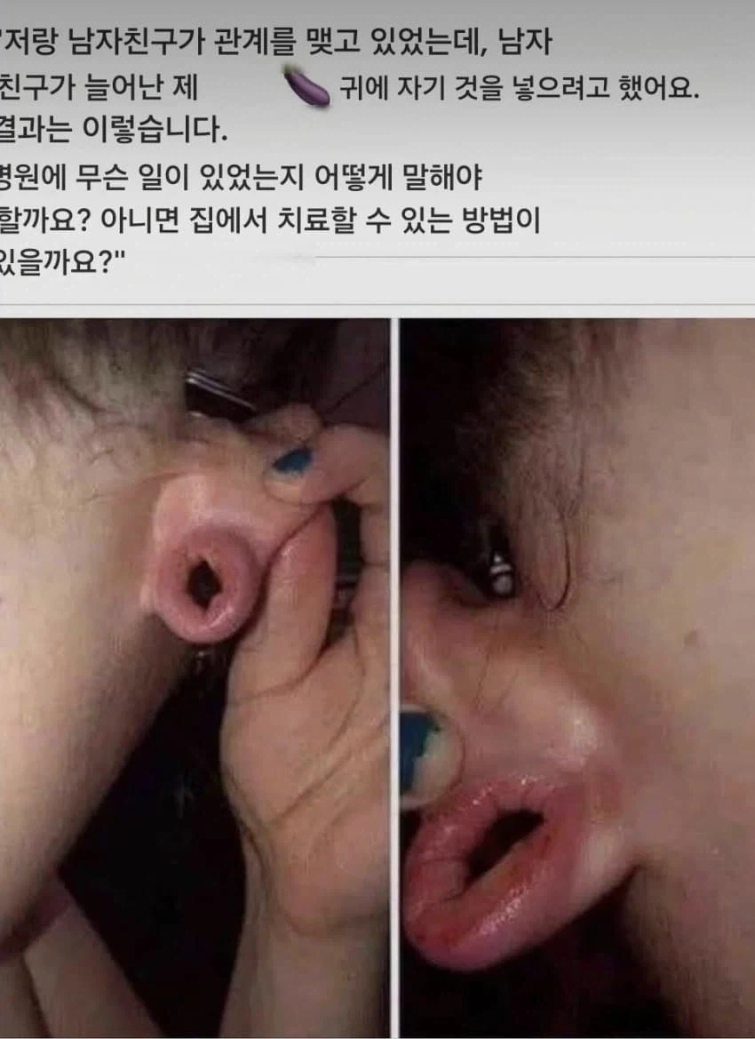 귓구멍에 좋 박았냐?_1.webp