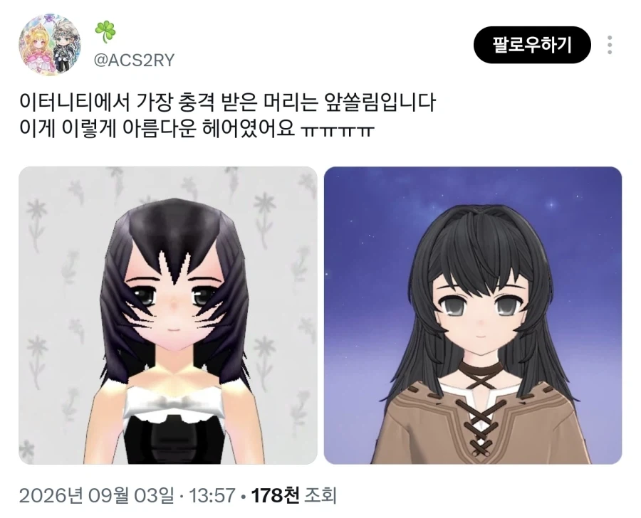 성형수술 전, 후_1.webp