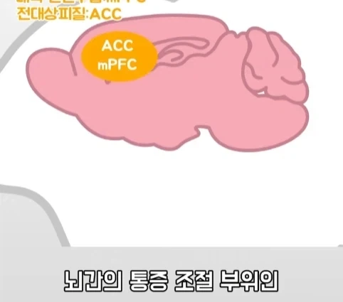 플라시보 효과는 단순 기분탓이 아니라는 연구.jpg_27.webp