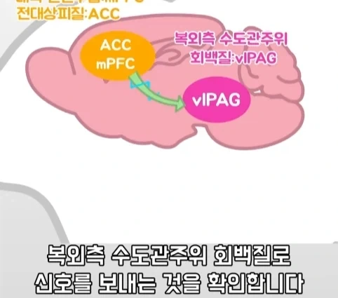 플라시보 효과는 단순 기분탓이 아니라는 연구.jpg_28.webp