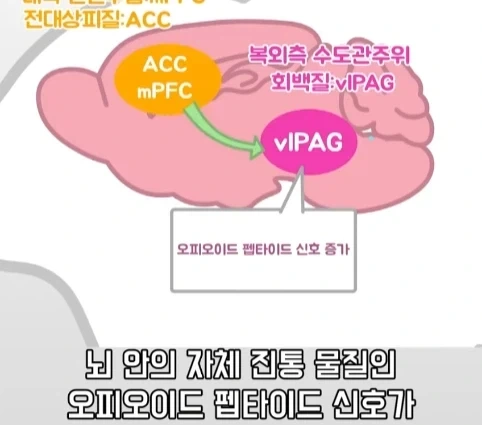 플라시보 효과는 단순 기분탓이 아니라는 연구.jpg_30.webp