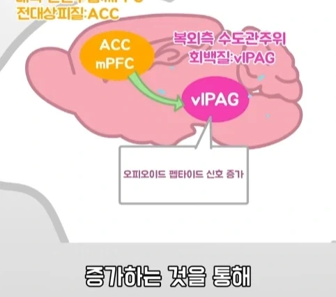 플라시보 효과는 단순 기분탓이 아니라는 연구.jpg_31.webp