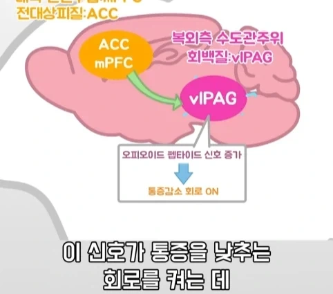 플라시보 효과는 단순 기분탓이 아니라는 연구.jpg_32.webp