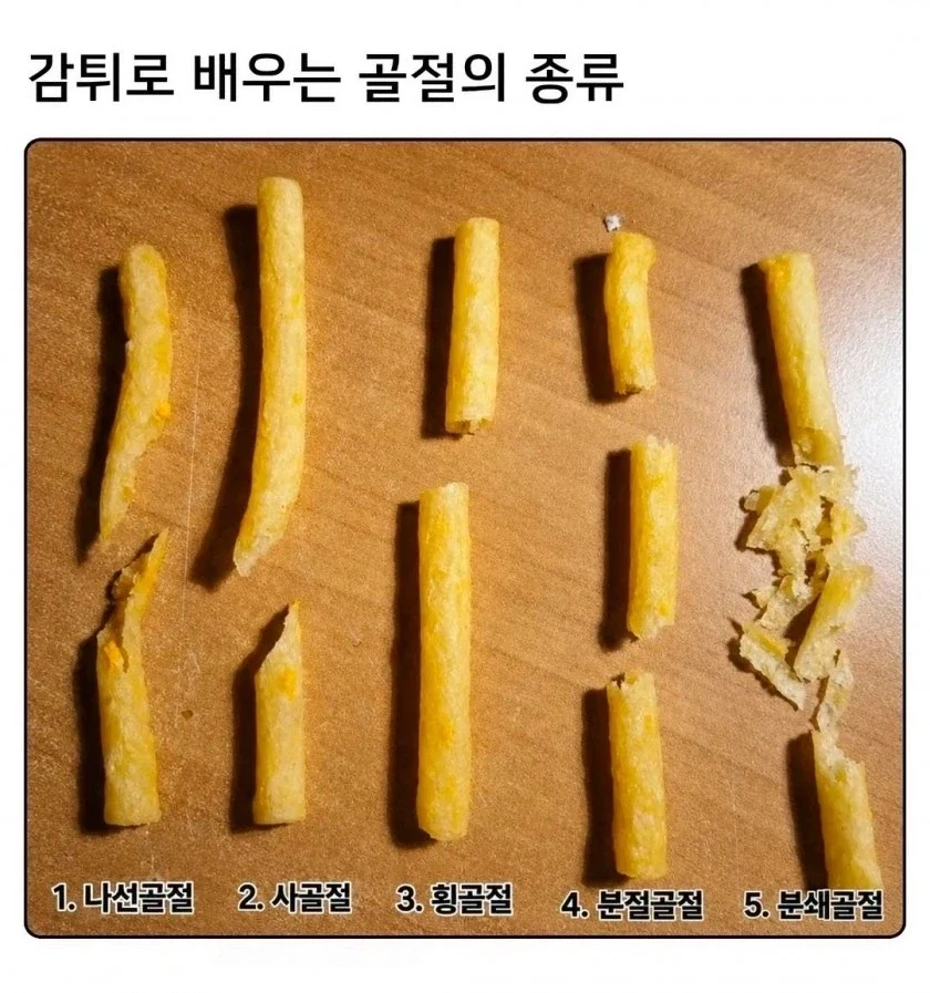 감튀로 배우는 골절의 종류_1.webp