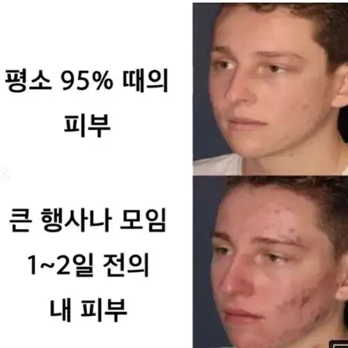 약속날 피부상태 공감_1.webp