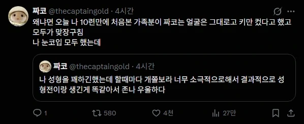 성형 했는데 의미가 없음_1.webp