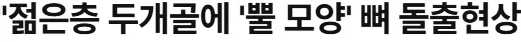 두개골에 뿔이 점점 자라나고 있다는 현대 인류.news_2.webp