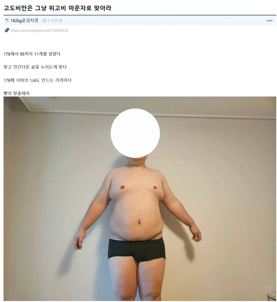 마운자로로 176KG에서 95KG까지 뺐다는 사람... ㄷㄷ;;;_1.webp