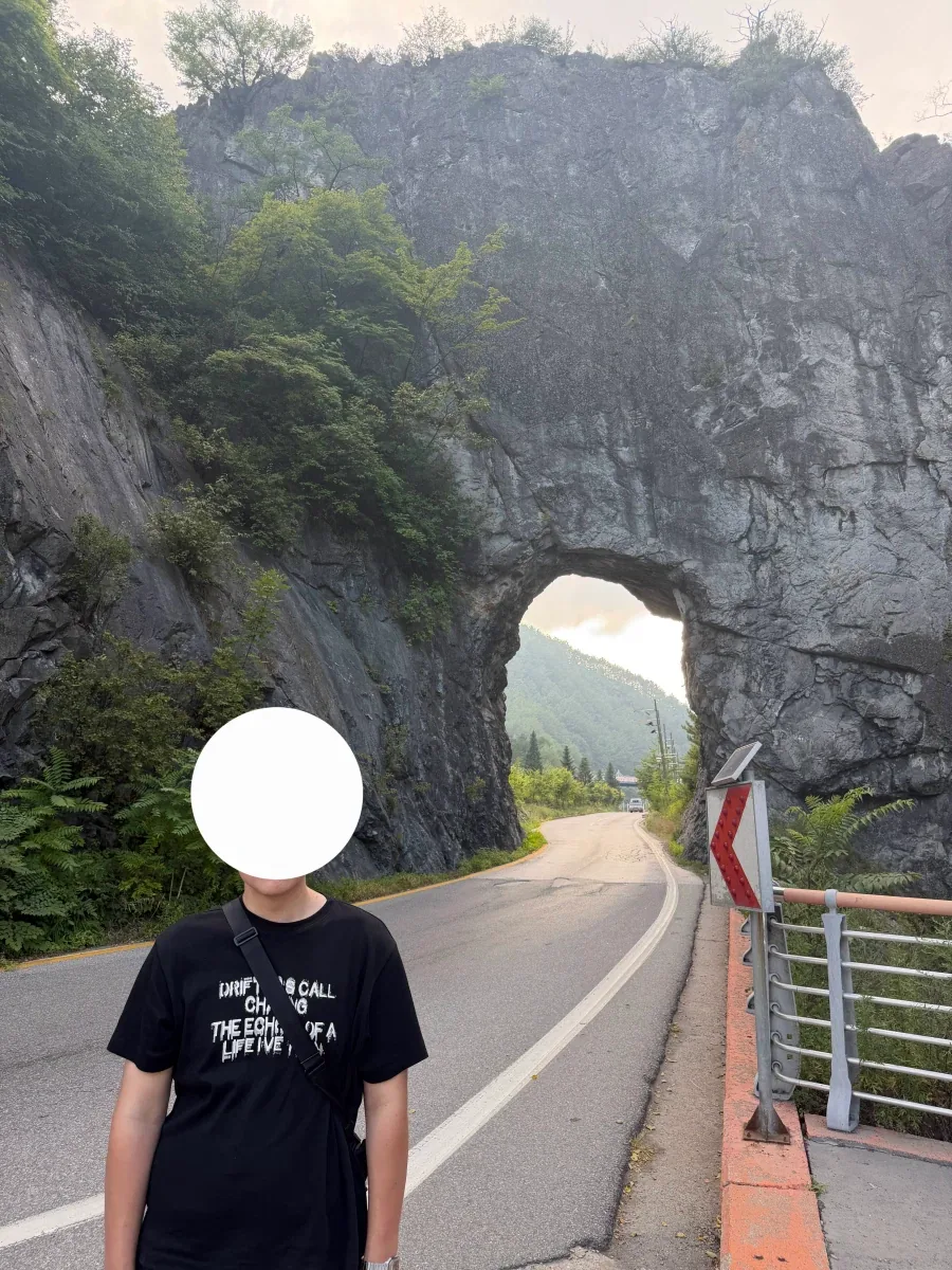 마운자로로 176KG에서 95KG까지 뺐다는 사람... ㄷㄷ;;;_2.webp