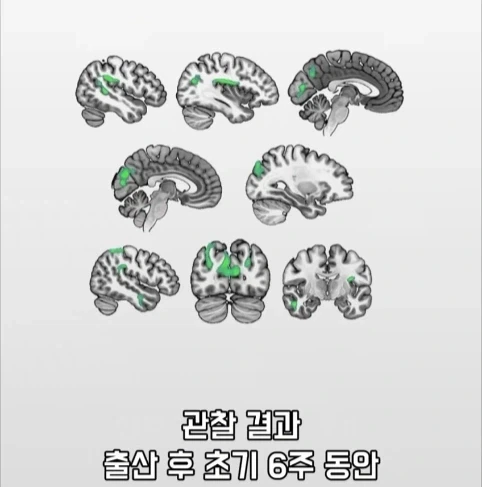 아빠가 되면 남자의 몸에도 변화가 생긴다는 연구.jpg_18.webp