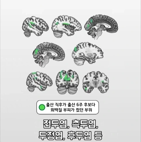 아빠가 되면 남자의 몸에도 변화가 생긴다는 연구.jpg_19.webp