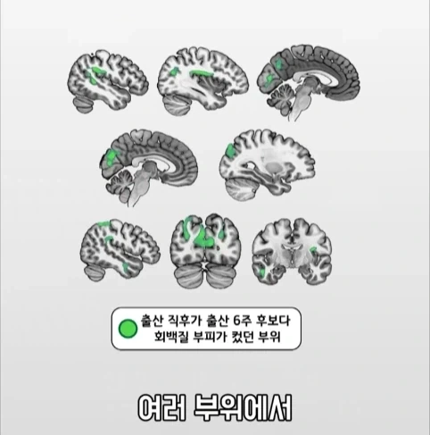 아빠가 되면 남자의 몸에도 변화가 생긴다는 연구.jpg_20.webp