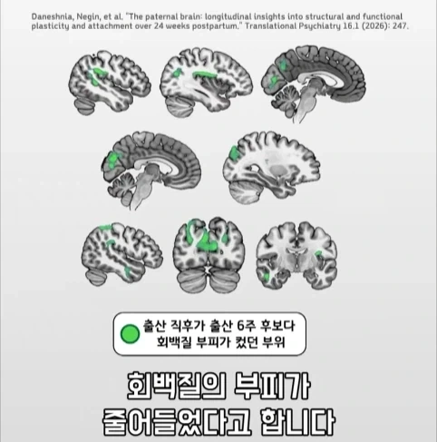 아빠가 되면 남자의 몸에도 변화가 생긴다는 연구.jpg_21.webp