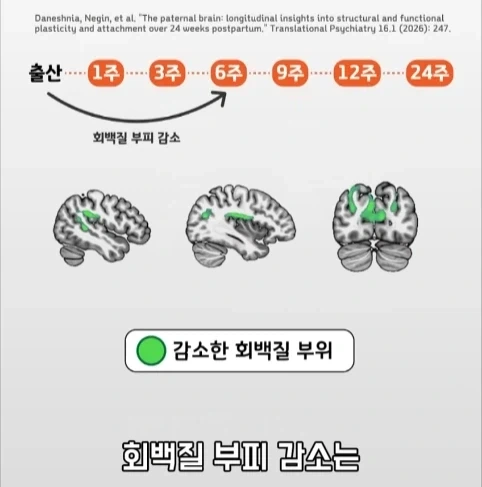 아빠가 되면 남자의 몸에도 변화가 생긴다는 연구.jpg_26.webp