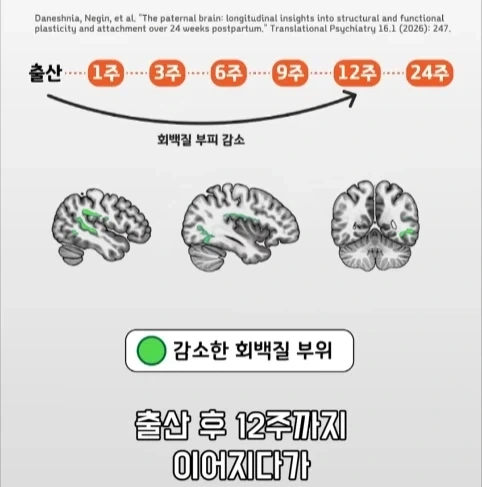 아빠가 되면 남자의 몸에도 변화가 생긴다는 연구.jpg_27.webp