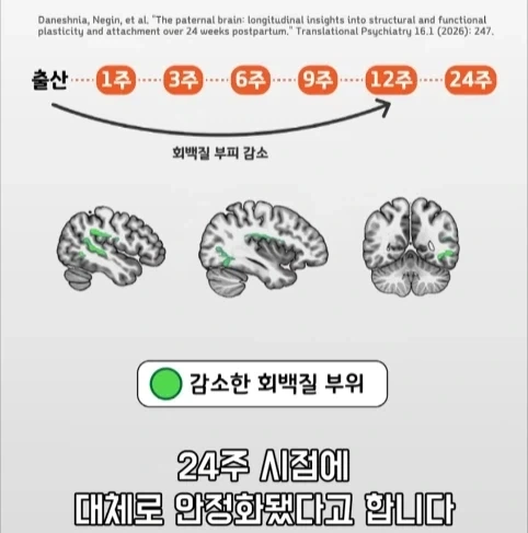 아빠가 되면 남자의 몸에도 변화가 생긴다는 연구.jpg_28.webp