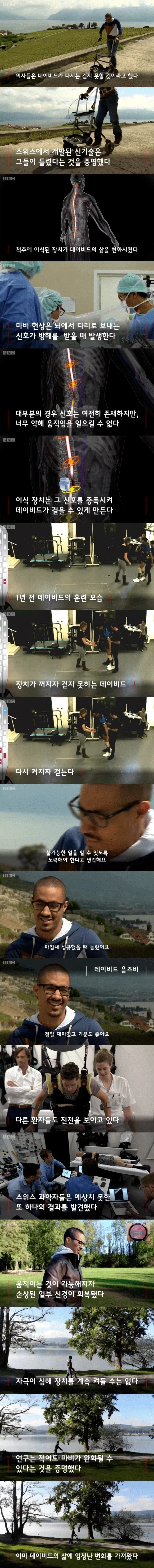 사이버웨어를 장착하여 인생이 실제로 바뀐 사람.jpg_1.webp