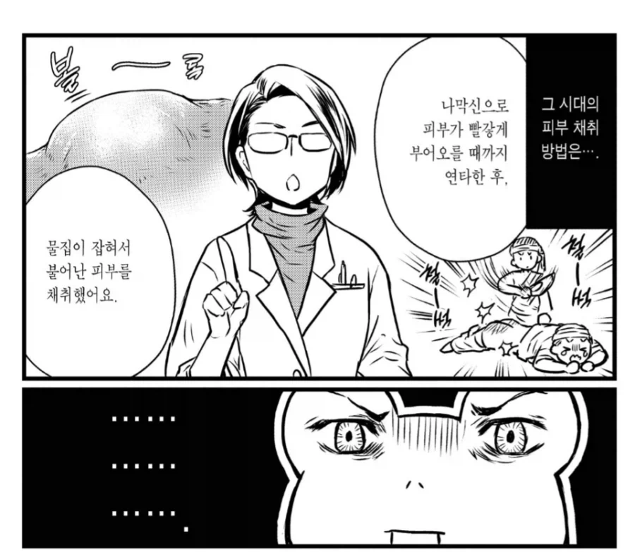 고대 린도의 피부이식수술_2.webp