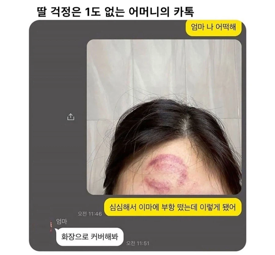 심심해서 이마에 장난쳤다가 엄마에게 해결책을 물어봤다_1.webp