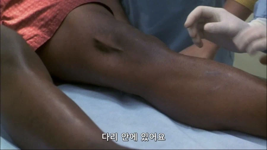 엉덩이속에 벌레간 들어간 남자_5.webp