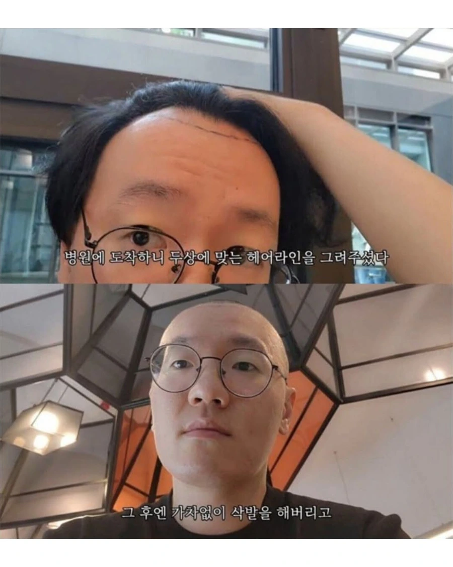 b552d3f38d5640ff9a04613567a43065.jpg 터키로 모발이식 받으러간 남자의 최후.jpg