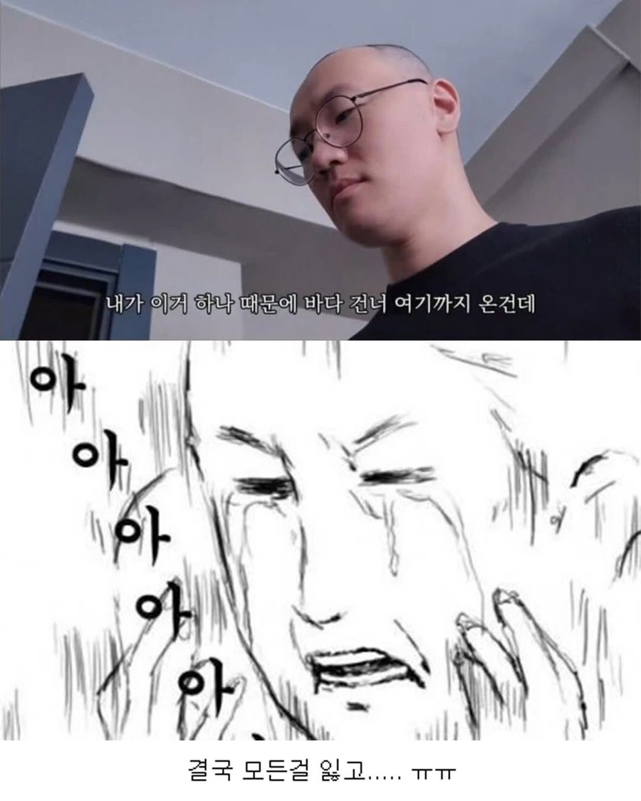 cfa354806ec144a89b8c01fca9599c90.jpg 터키로 모발이식 받으러간 남자의 최후.jpg