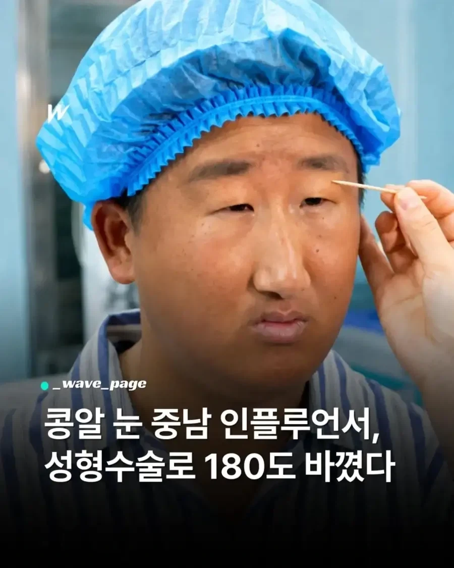 성형수술로 180도 바뀐 남자_1.webp