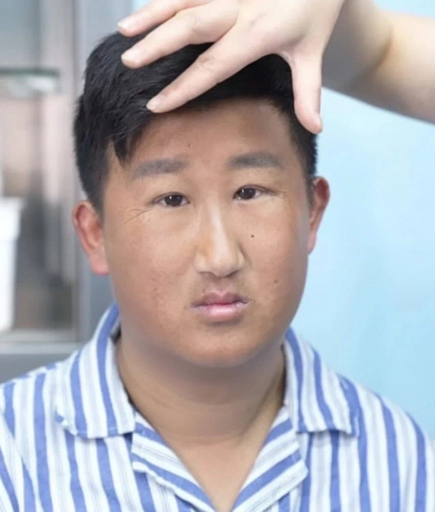성형수술로 180도 바뀐 남자_2.webp
