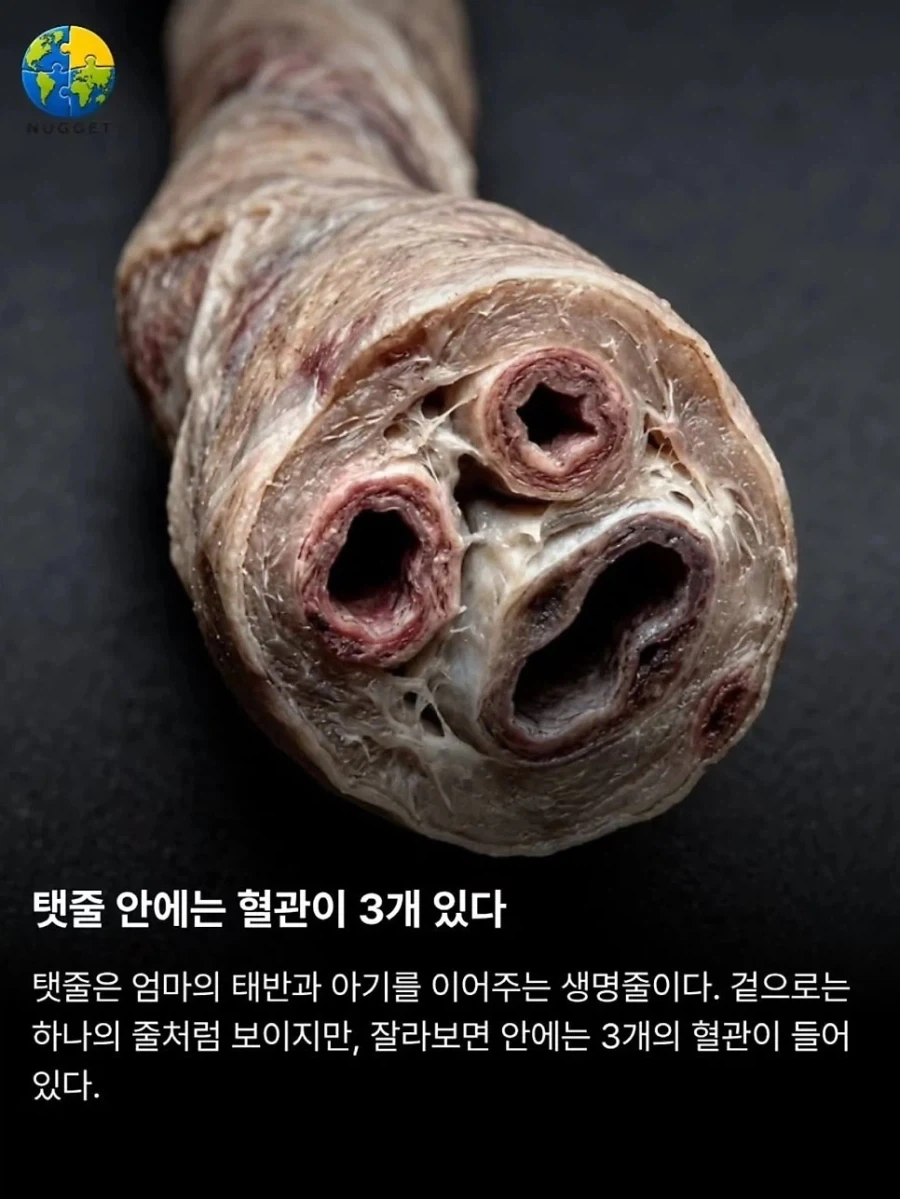 탯줄이야기._1.webp