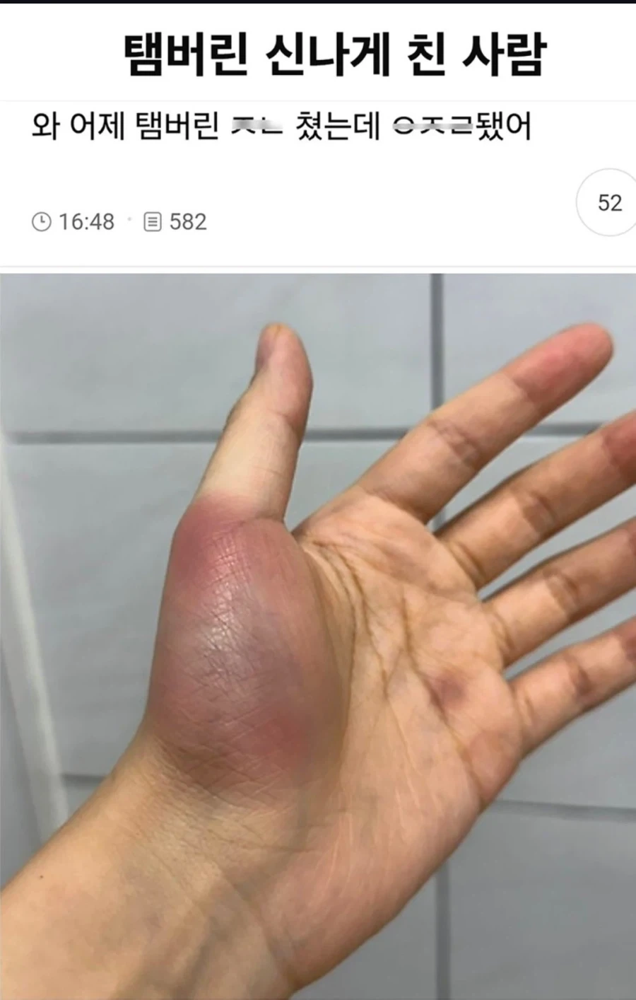 너무 신나게 논 대가_1.webp