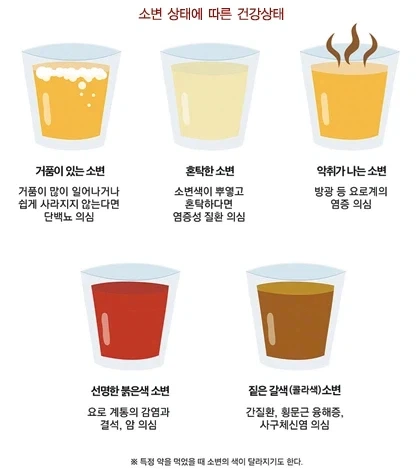 그림으로 보는 소변 상태_1.webp