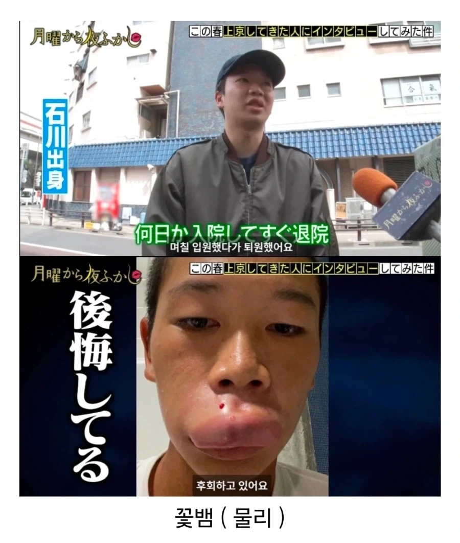 도쿄에 오자마자 꽃뱀에게 물린 시골 청년.jpg_4.webp