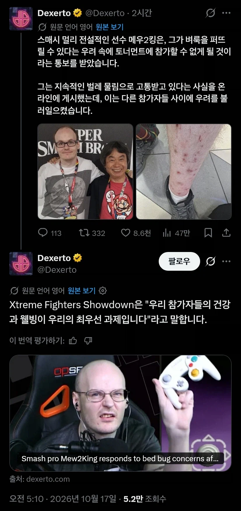 안씻는덕후 최종보스가 등장한 미국_1.webp