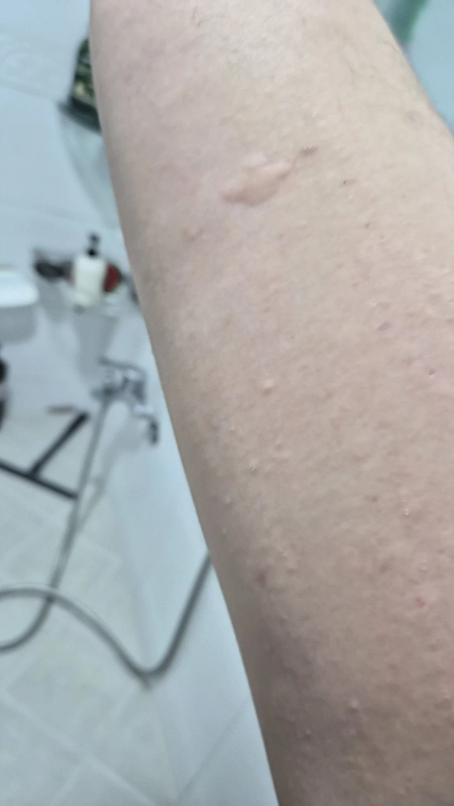 아 ㅁ발 또 뭔 알러지여_1.webp