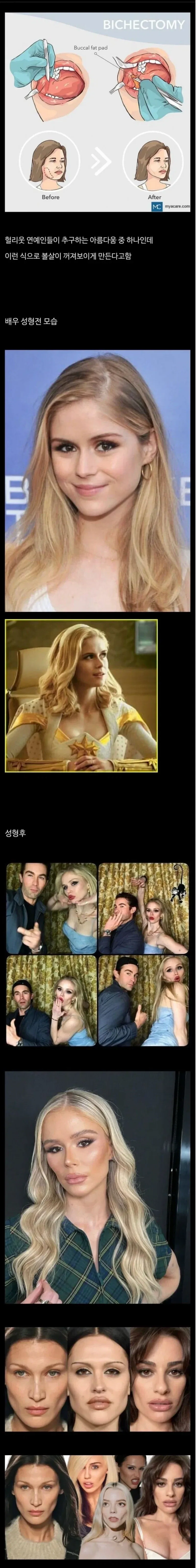 미국에서 동양인 캐 그릴 때 광대 강조하는건 동양인 스테레오 타입이라기보다는_1.webp