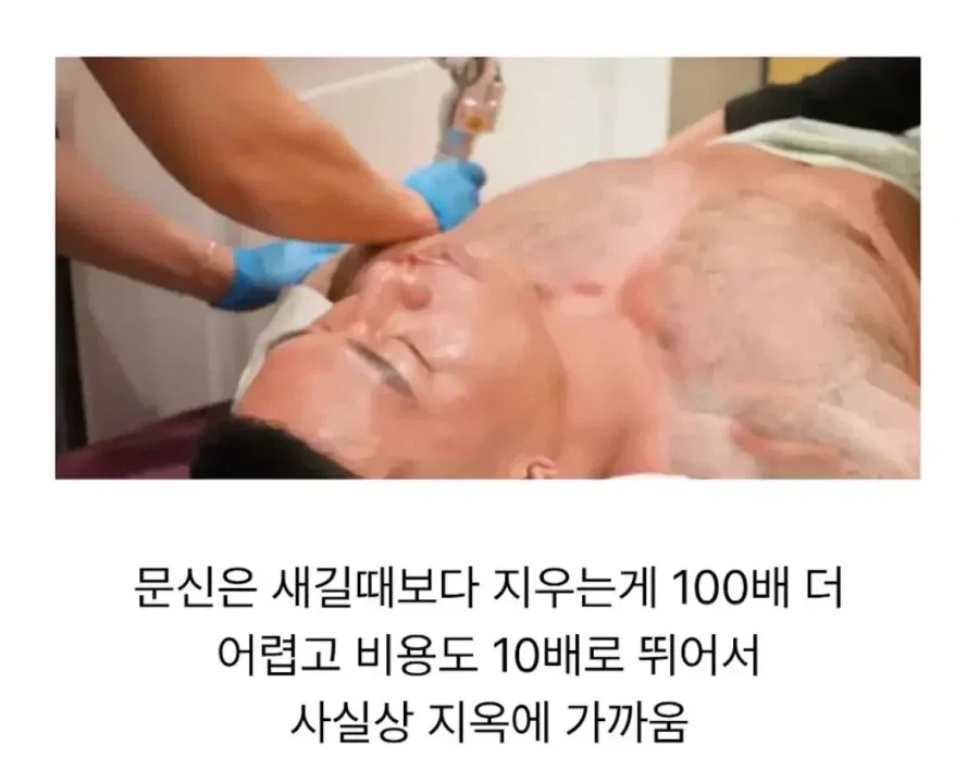 딸이 태어나고 문신을 다 지운 아빠.jpg_4.webp