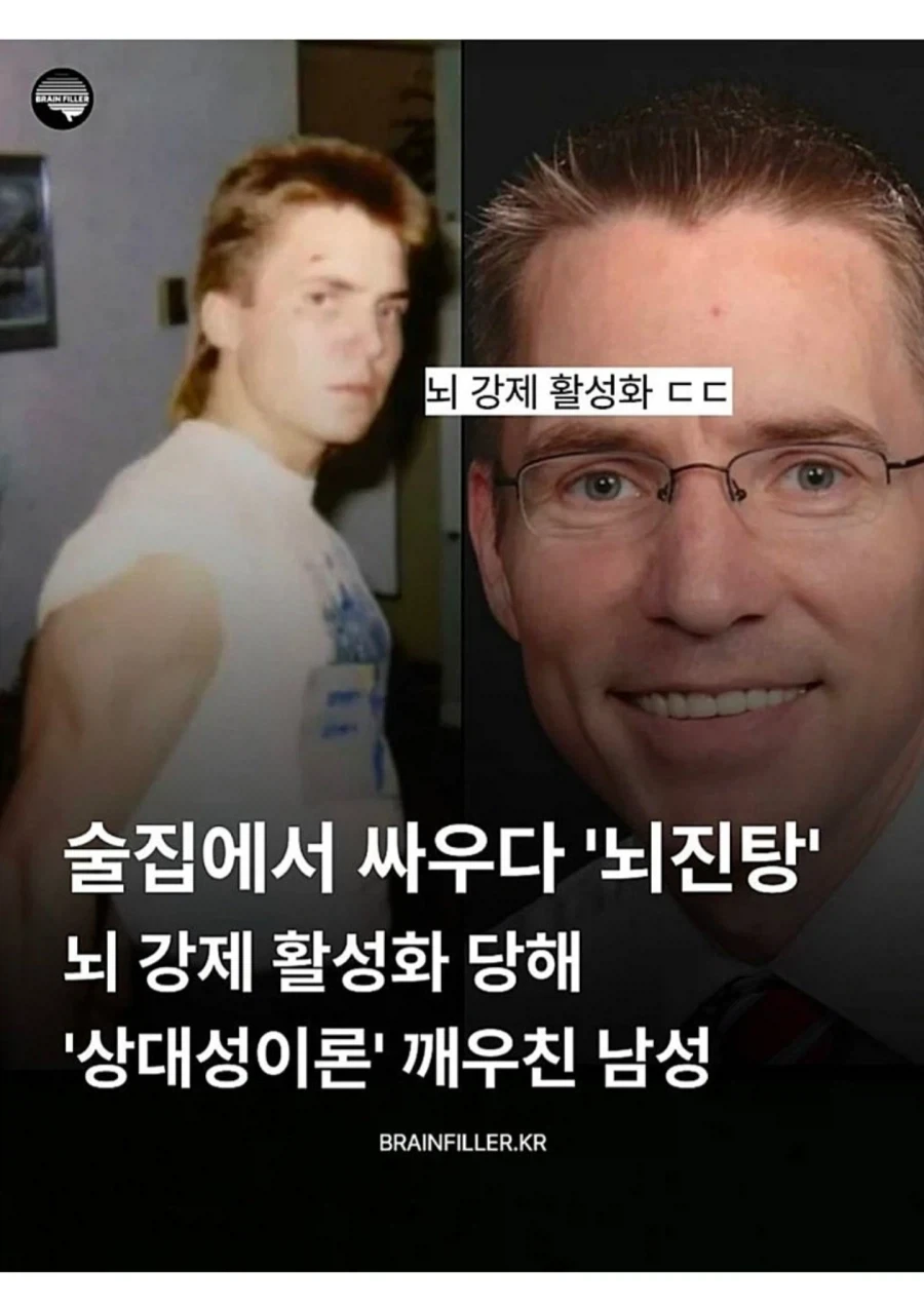 뇌진탕으로 천재가 된 남성 ㄷㄷㄷ;,_1.webp