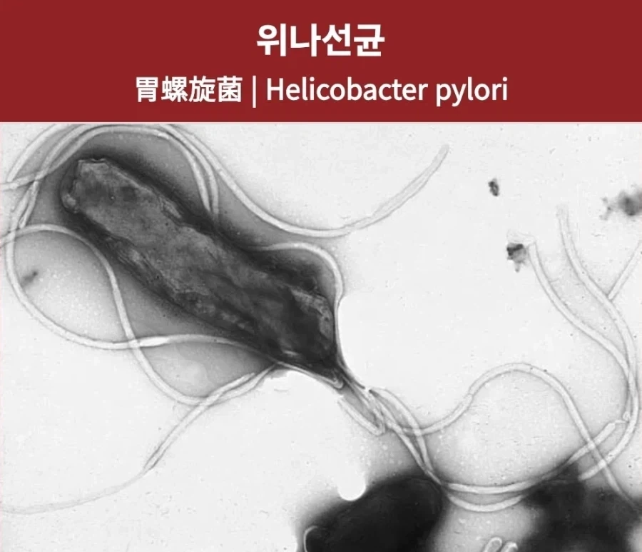 이 로리를 보고 박고 싶다는 충동이 든다면 의사와 상의하셔야 합니다._1.webp