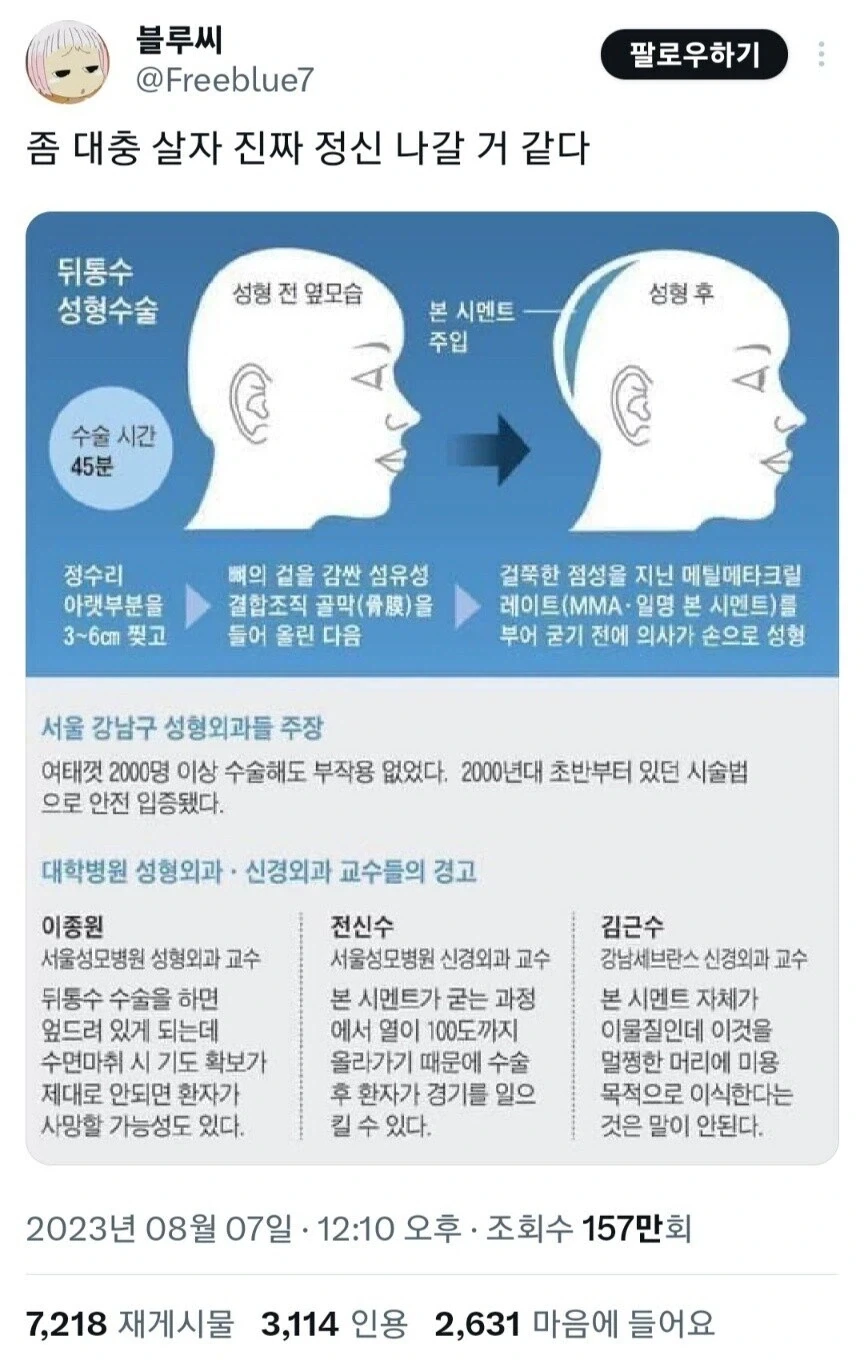 사펑 임플란트 현실판_1.webp