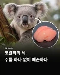 뇌에 주름이 하나도 없으면 생기는 일 jpg_1.webp