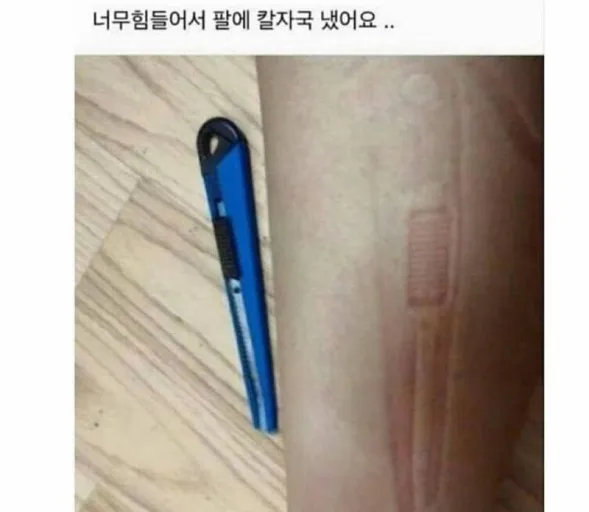 너무 힘들어서 팔에 칼자국 냈어..._1.webp