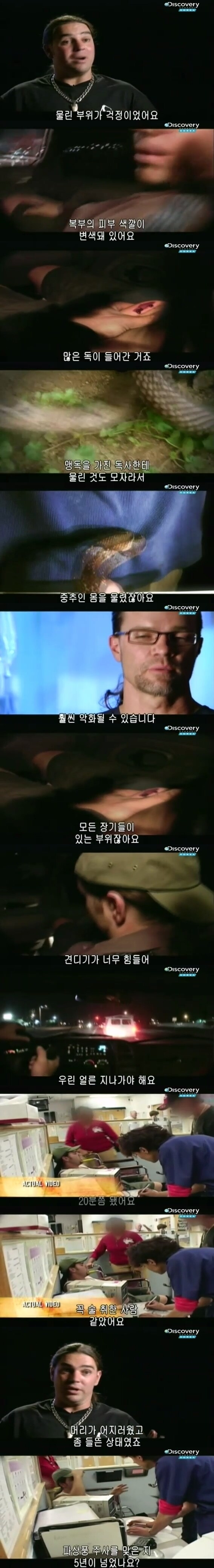 [극혐] 코브라한테 물려서 몸에 구멍이 생긴 남자.jpg_6.jpg