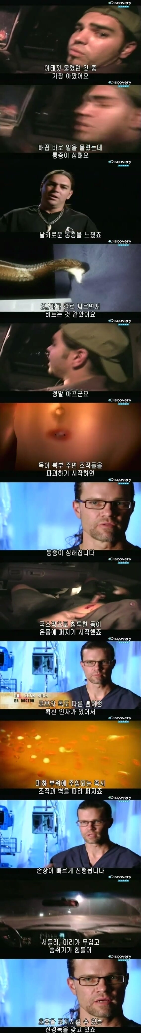 [극혐] 코브라한테 물려서 몸에 구멍이 생긴 남자.jpg_5.jpg