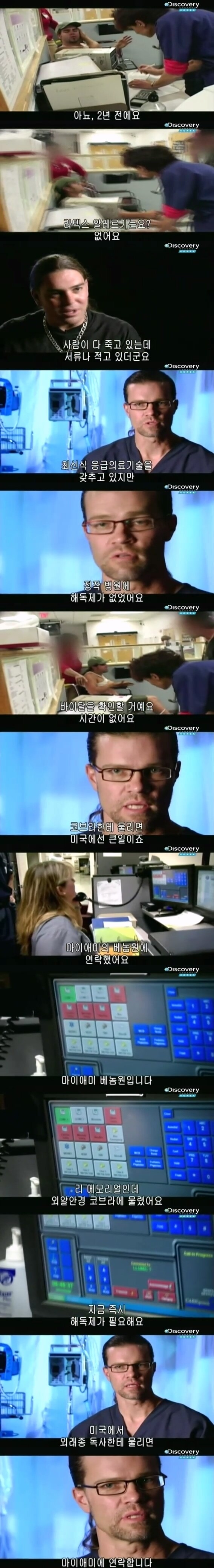 [극혐] 코브라한테 물려서 몸에 구멍이 생긴 남자.jpg_7.jpg