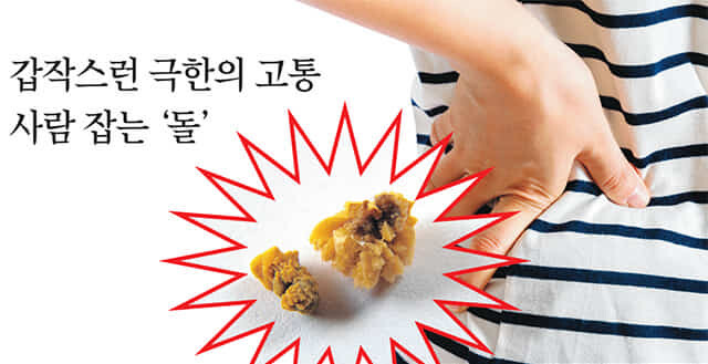 죽는병도 아닌데 마1약성 진통제를 쓰는, 인간이 견디기 어려운 최상급의 고통류 甲_1.jpg