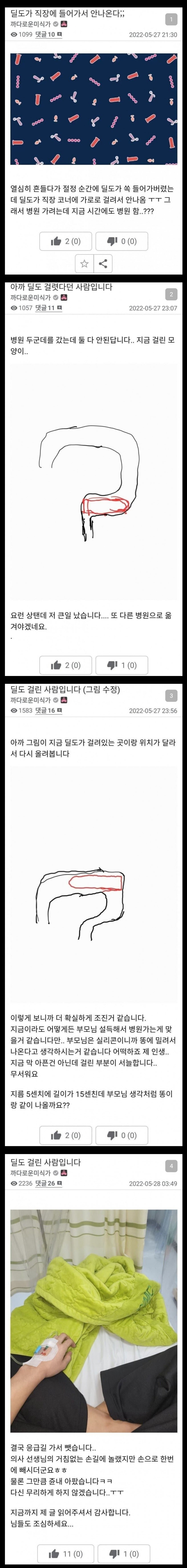 직장에 딜도 걸린 사람 후기_1.jpg