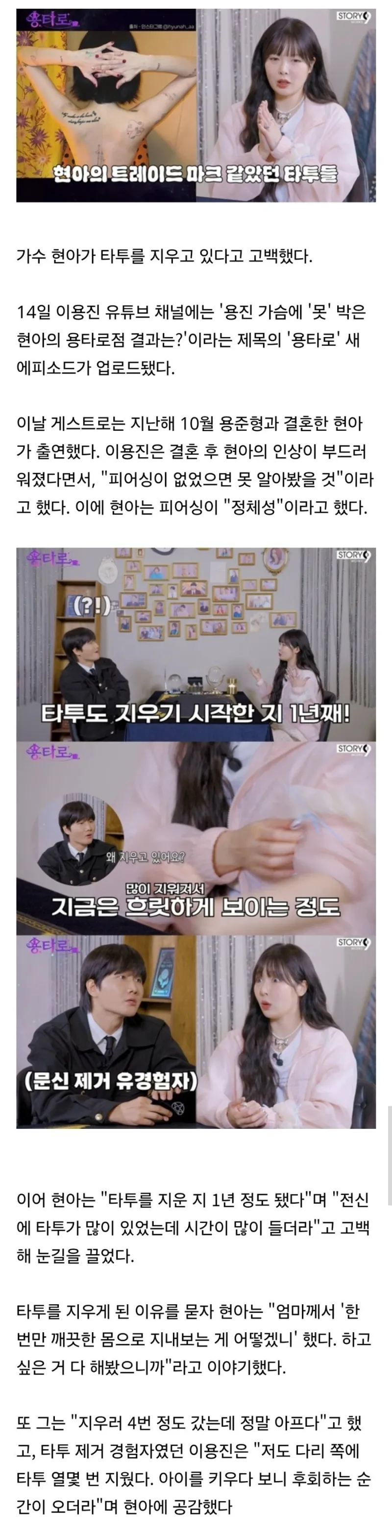 문신 지우고 있는 중인 현아._1.webp