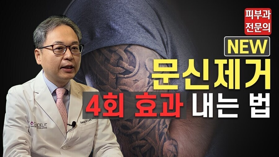 탁월한 문신제거 시술법_1.jpg