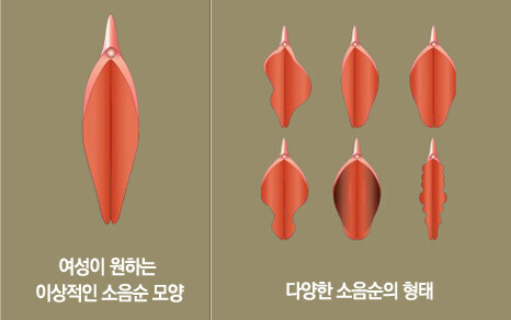 소음순 정리_1.jpg